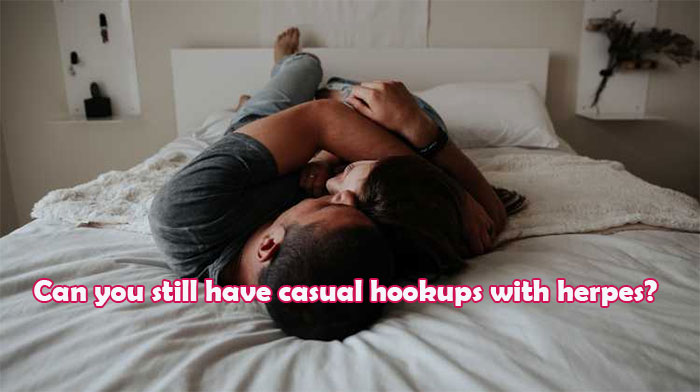 Can I still have casual hookups with herpes? Can you have hookups if you have herpes?