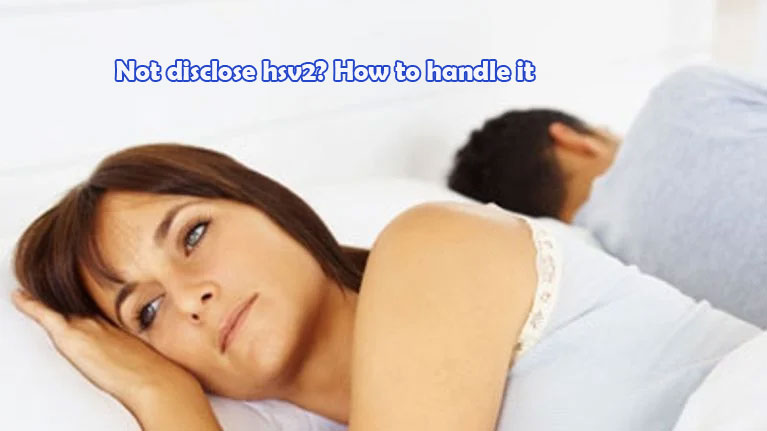 Not disclose hsv2? How to handle it